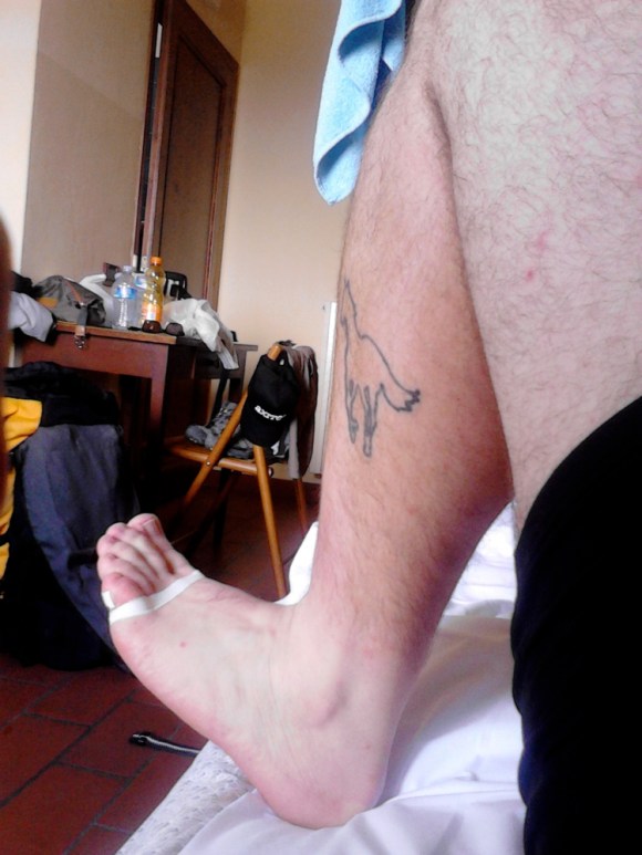 Impalcatura antivescicale